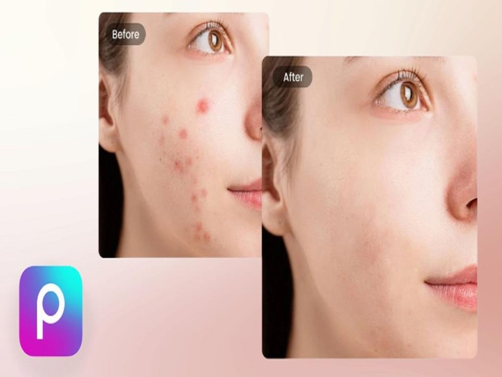 Top các app xóa mụn tốt nhất cho người không rành chỉnh ảnh