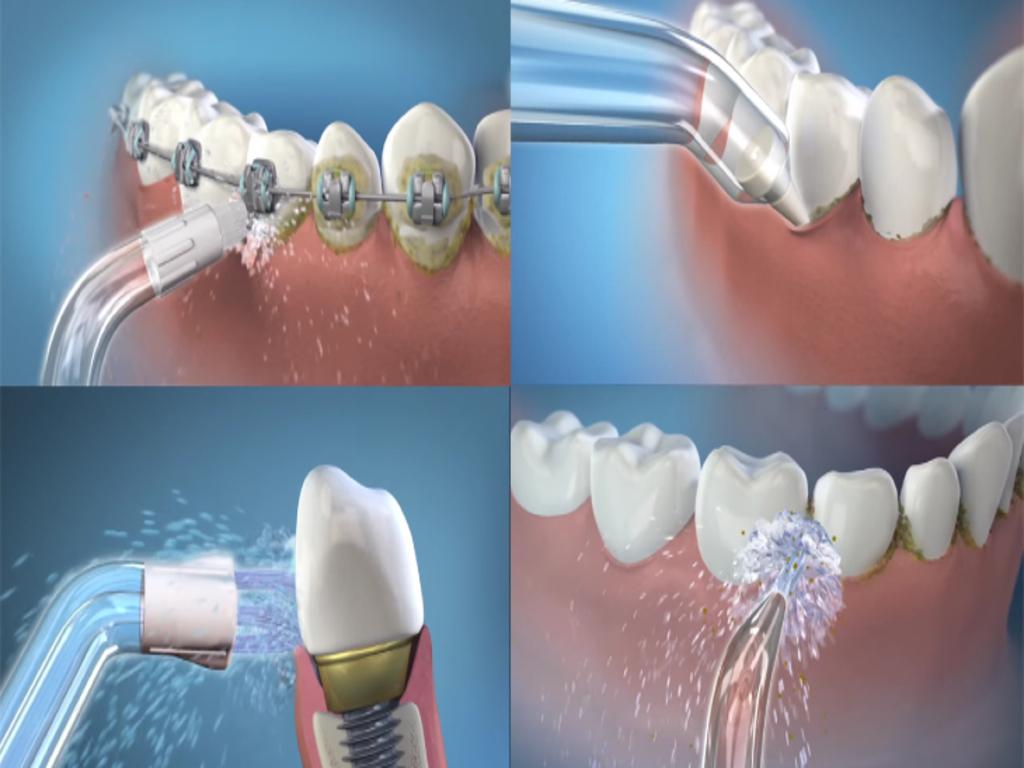 Mẹo vệ sinh răng miệng hiệu quả bằng máy tăm nước