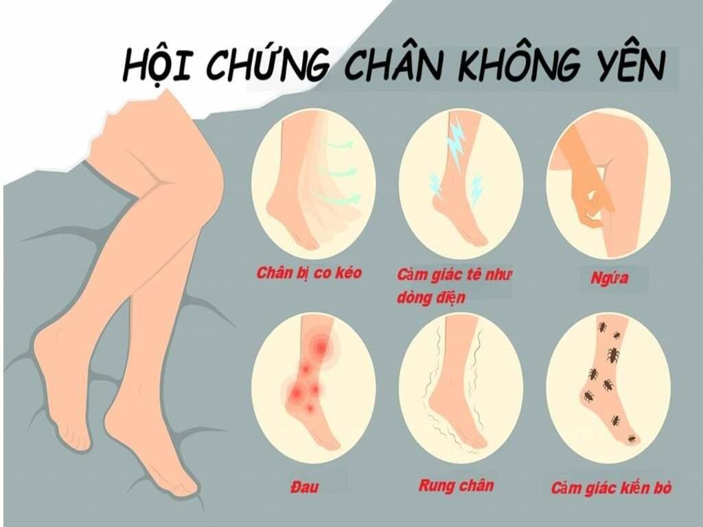 Nhận biết các triệu chứng chân không yên phổ biến