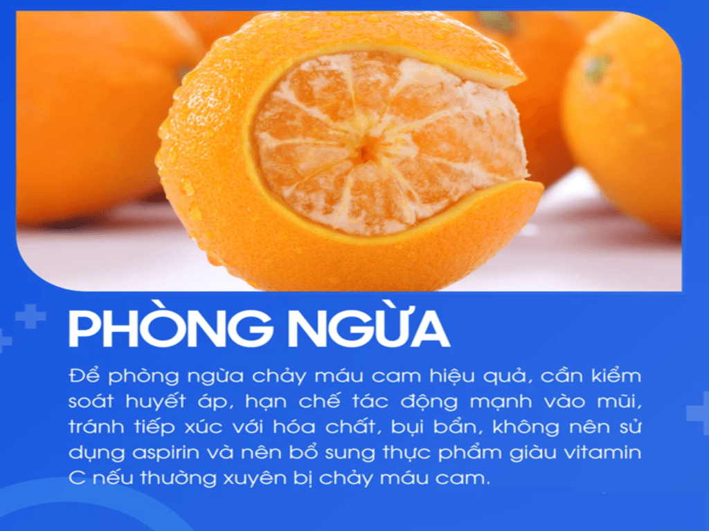 Cách làm hết chảy máu mũi hiệu quả