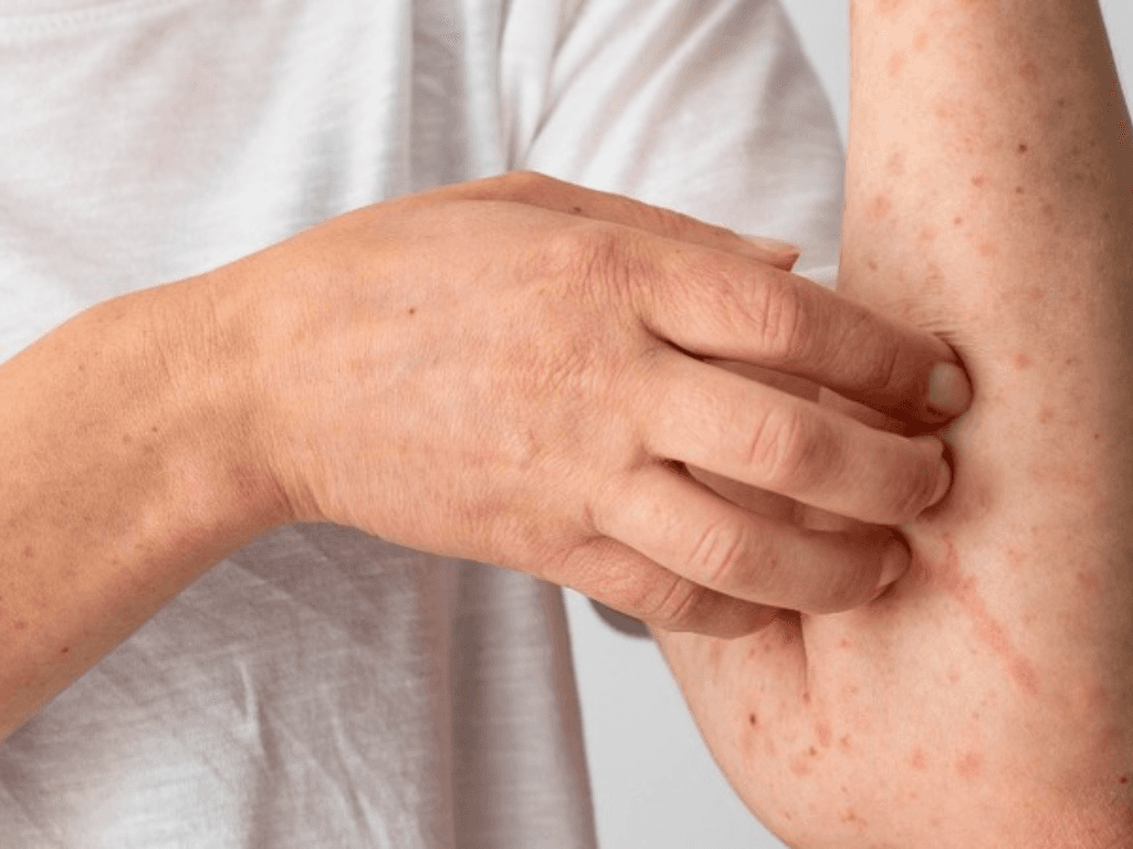 chay-nang-khi-kem-chong-nang-khong-du-de-bao-ve-lan-da