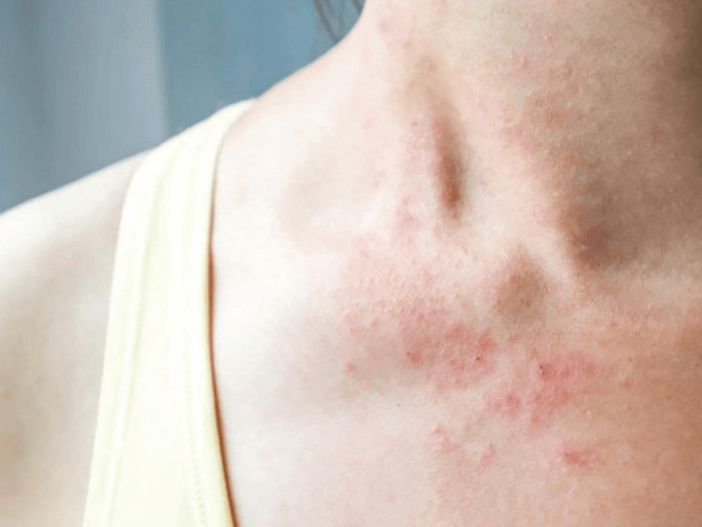 cham-da-mua-he-5-nguyen-tac-vang-de-da-khong-noi-loan