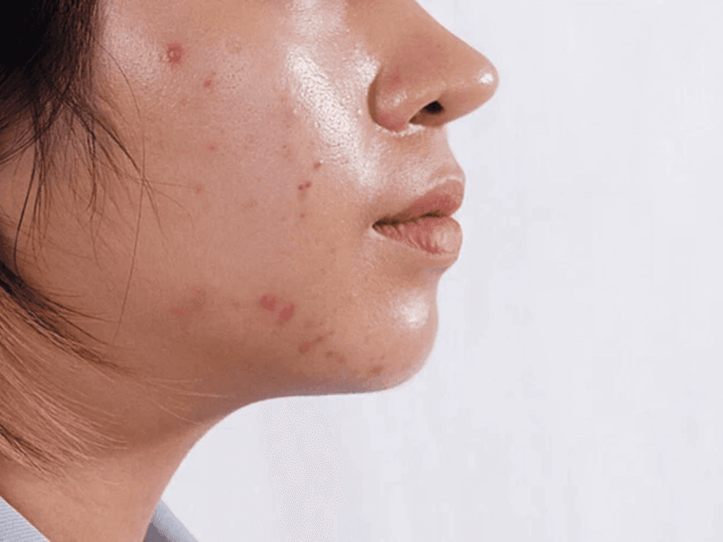 giai-phap-cuu-nguy-cho-lan-da-neu-bat-buoc-phai-thuc-khuya