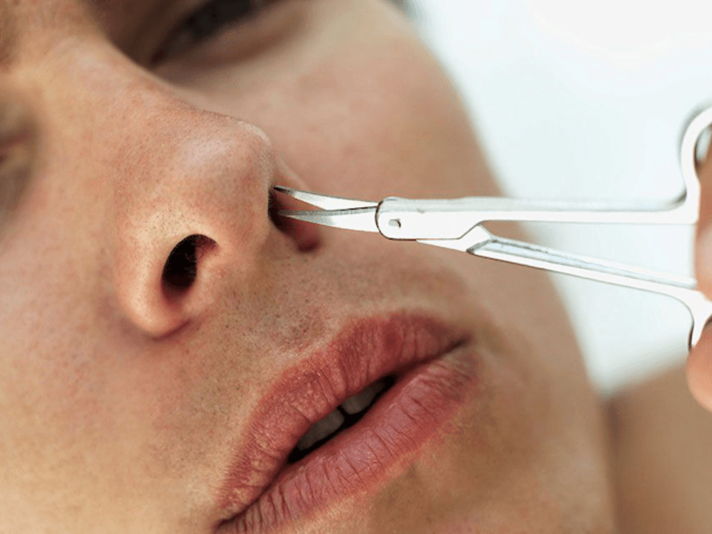 tai-sao-viec-tia-long-mui-dung-cach-lai-quan-trong