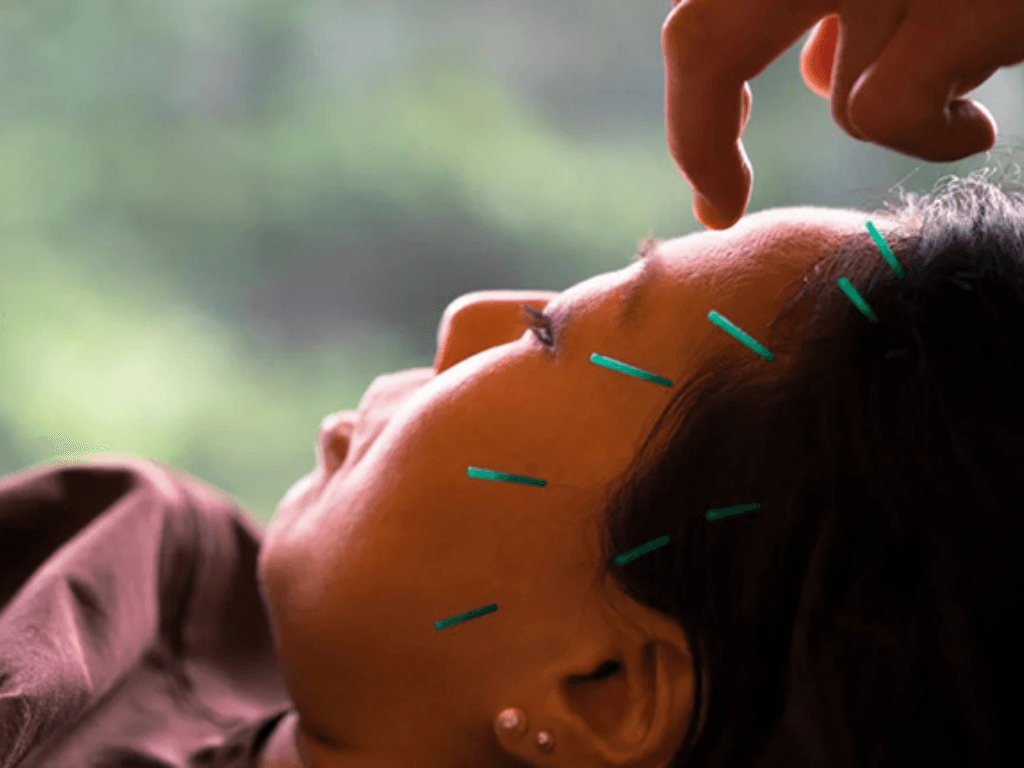 hieu-qua-thuc-te-cua-cham-cuu-trong-dieu-tri-mat-ngu