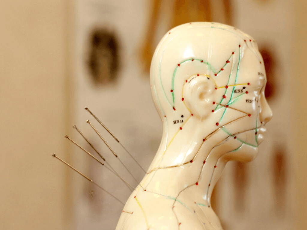 nhung-huyet-dao-quan-trong-trong-cham-cuu-giup-chua-mat-ngu