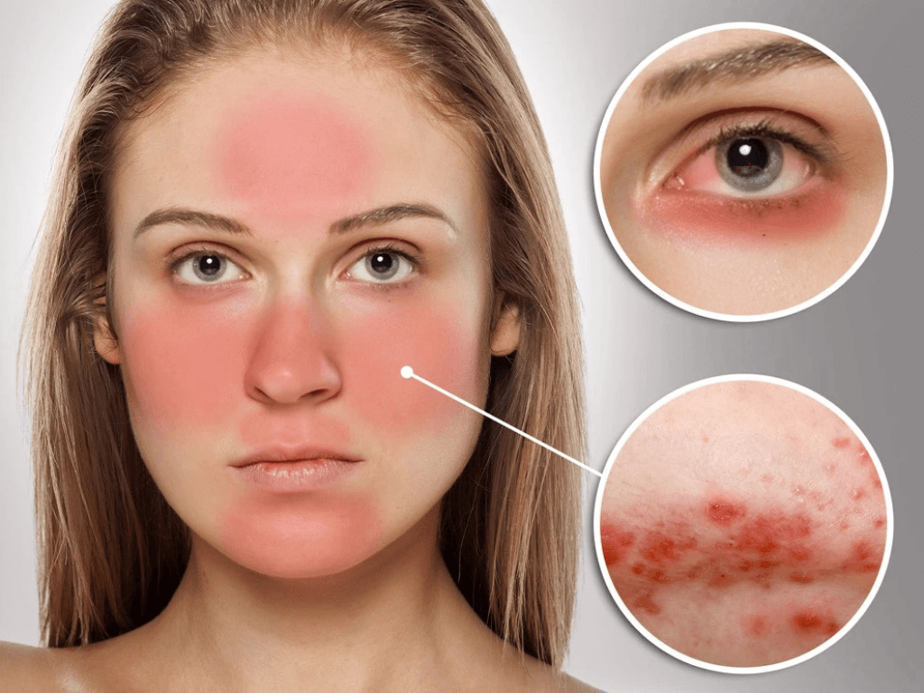 dau-hieu-cho-thay-ban-dang-rua-mat-qua-nhieu-hoac-qua-it