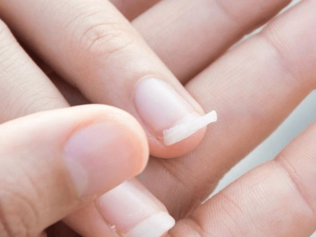 nguyen-nhan-mong-yeu-de-gay