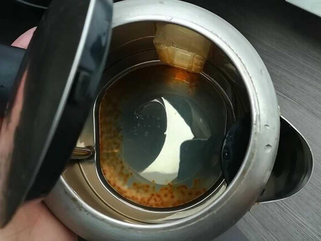 nguyen-nhan-am-sieu-toc-bi-gi