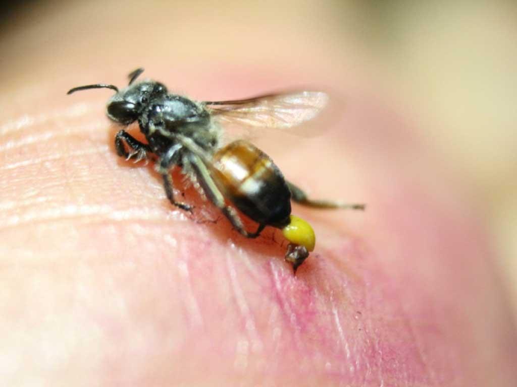 cach-xu-ly-khi-bi-ong-ong-dot