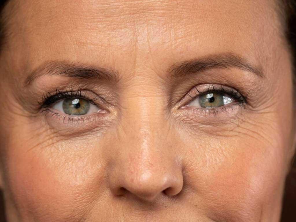 kem-xoa-nep-nhan-vung-mat-cua-nhat-co-tri-nep-nhan-lau-nam-khong