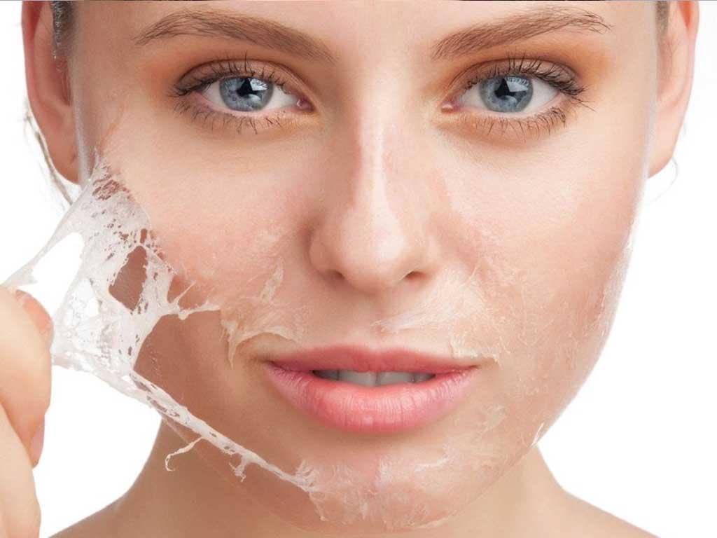 rau-ma-co-tac-dung-giam-tham-nam