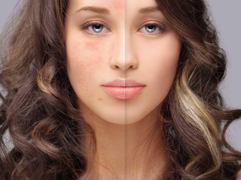 rau-ma-co-tac-dung-lam-diu-mun