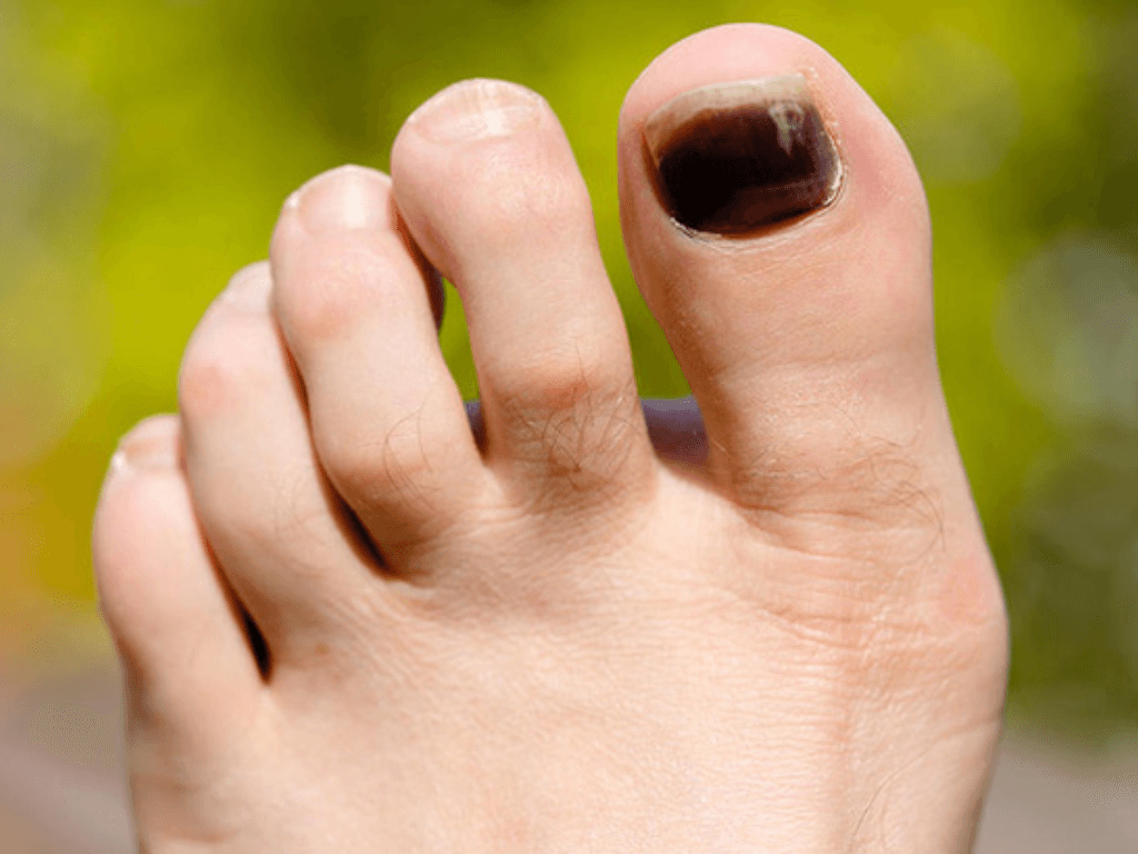 Mong-chan-bi-dap-tu-mau-phai-lam-sao