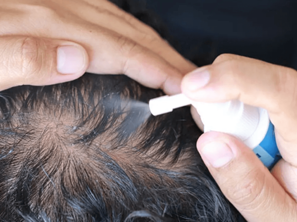 Co-che-hoat-dong-cua-Minoxidil