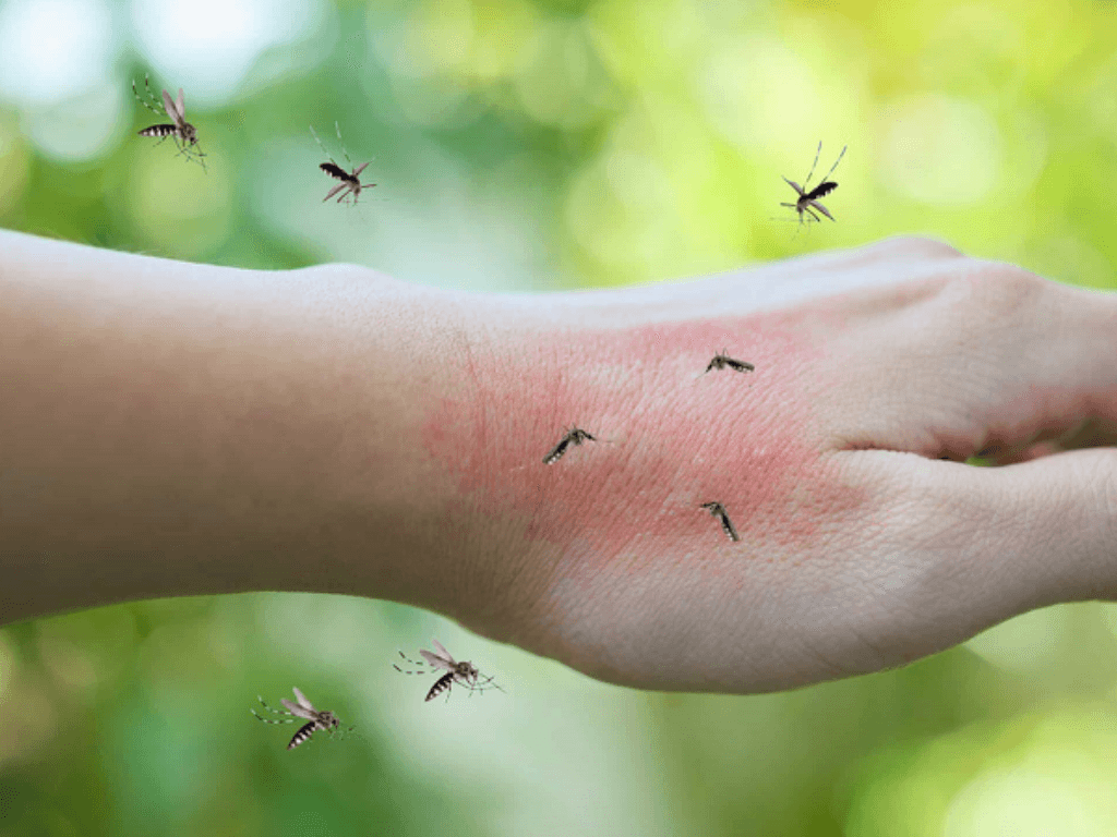 Nguyên nhân bị muỗi đốt nhiều hơn người khác không phải vì bạn “ngon” hơn đâu