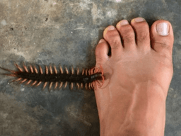 bị rết cắn phải làm gì