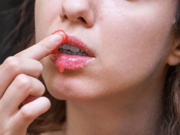 cách trị khô môi tại nhà nhanh nhất