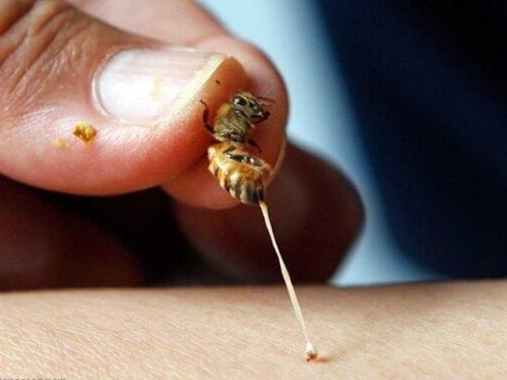 Cách chữa ong đốt hết sưng nhanh nhất trong 10 phút không cần thuốc Tây