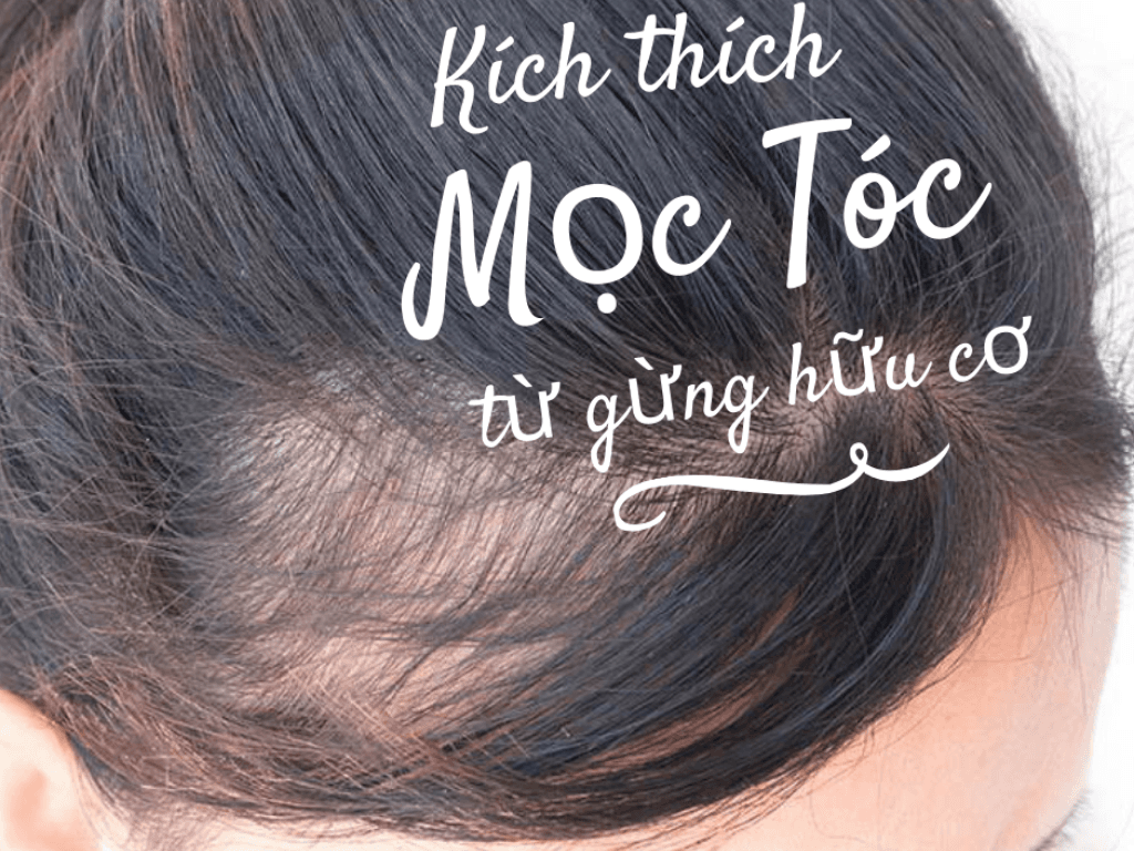 Cách chữa rụng tóc và kích thích mọc tóc kiểu “phù thủy”, ai thử cũng ngỡ ngàng