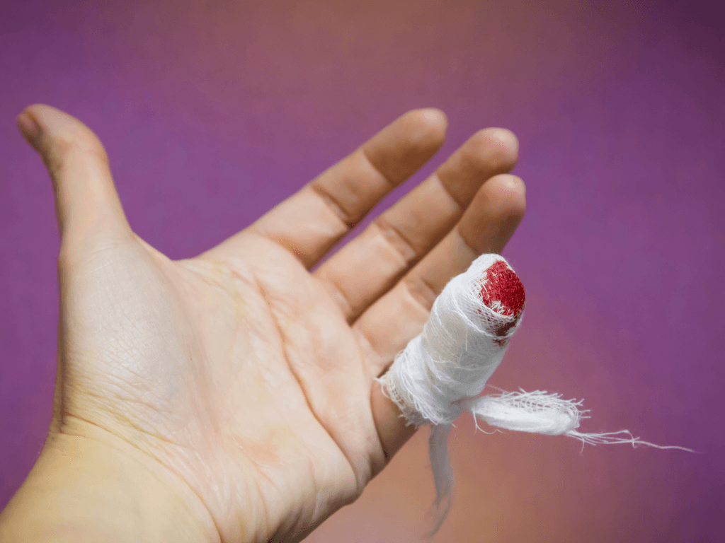 Cách cầm máu khi bị đứt đầu ngón tay: 1 mẹo nhỏ giúp cầm máu chỉ trong vài giây