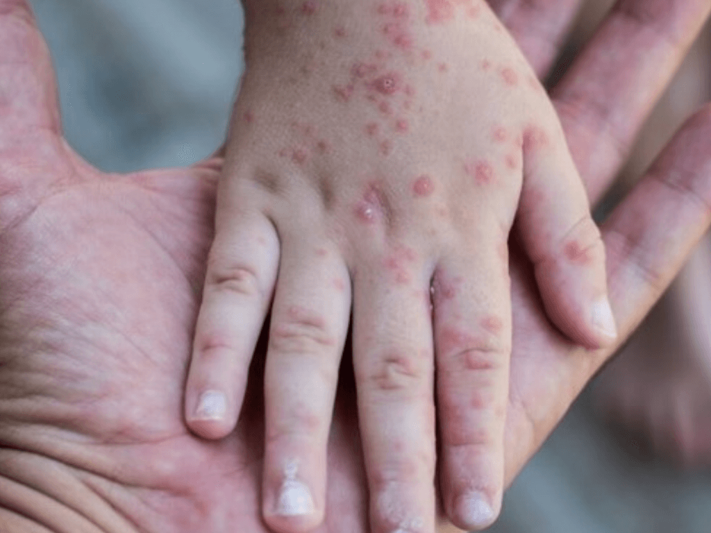 vi-sao-quan-niem-kieng-gio-kieng-quat-lai-pho-bien